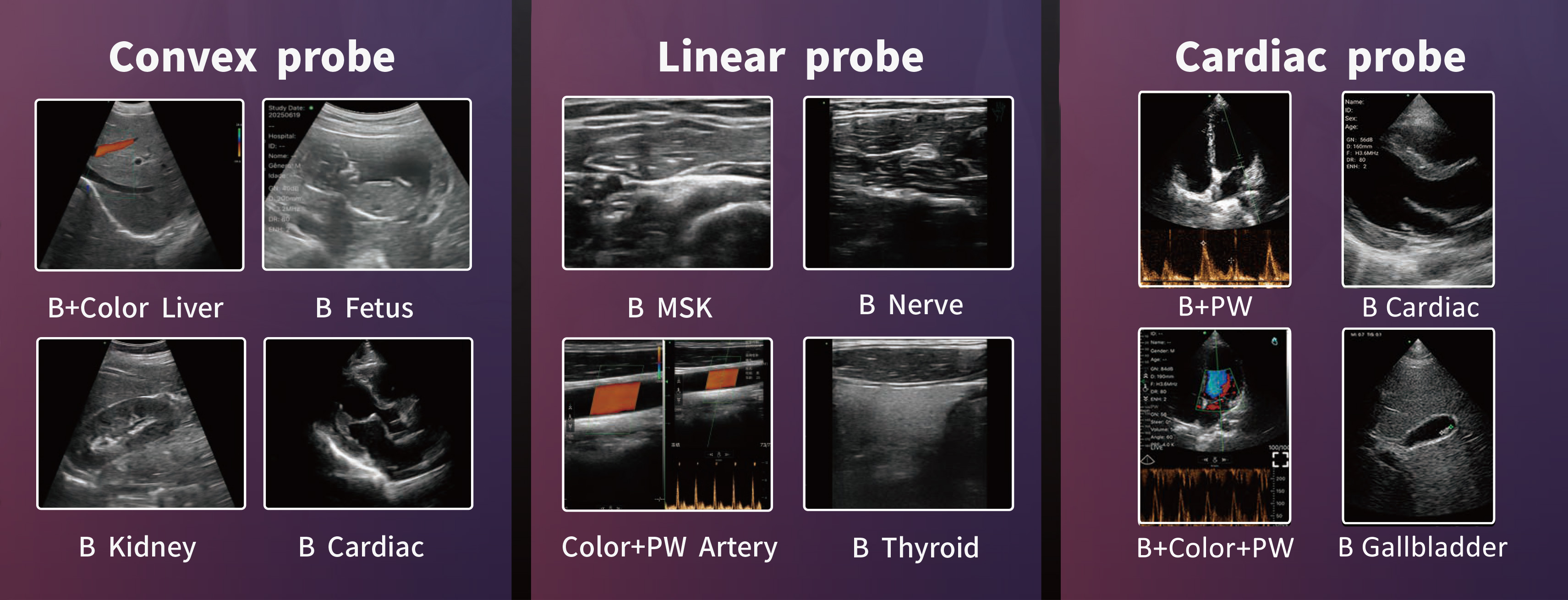 「FAMUBO-z」 超音波画像