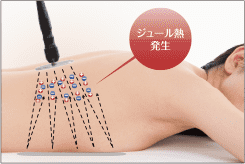 RAFOS premium pro 深部加温の原理