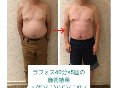 ラフォス40分×5回の施術後、こうなりました！｜クリニカルケア MOANA［モアナ］バイオエフェクト正規取扱店