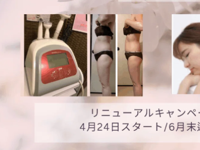 骨盤周りのコリをゆるめて、腰痛背中痛を和らげるラジオ波ラフォス