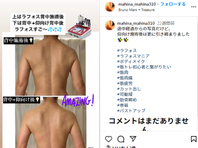 mahinaマヒナ | 途中経過からの写真だけど、 仰向け施術後は更に引き締まりました