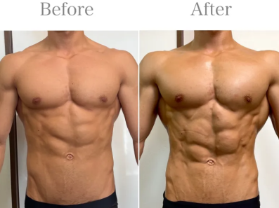 ラフォス筋肉カットだし | ソフィーム美容健康サロン (sofym.com)