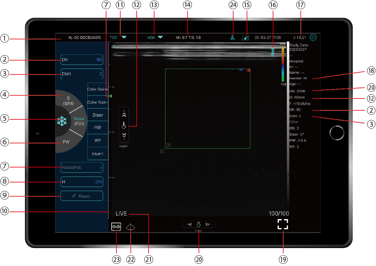 超音波画像計測のFAMUBO Interface